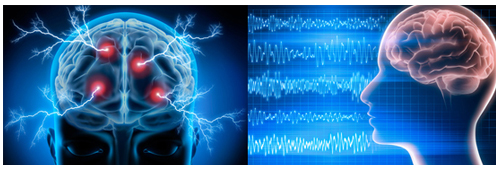 app-funktionell-hjarnavbildning-2-EEG-fran-biopac