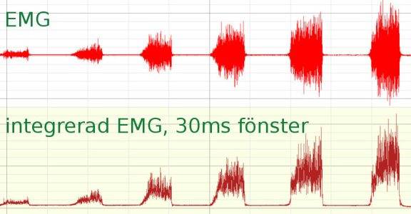 app-EMG-2-biopac