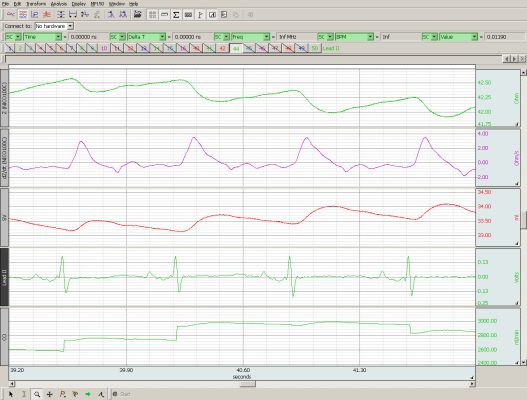 app-cardiac-output-2-biopac