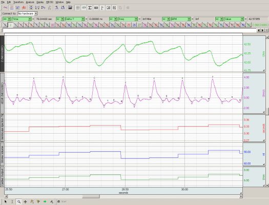 app-cardiac-output-3-biopac