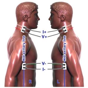 app-icg-och-cardiac-output