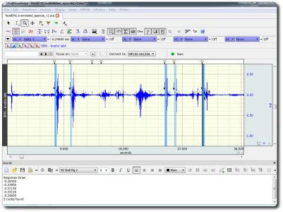 Applikation stimuli och respons analys i AcqKnowledge