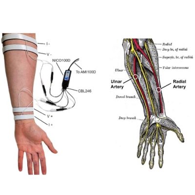 app-trev-measurement-biopac